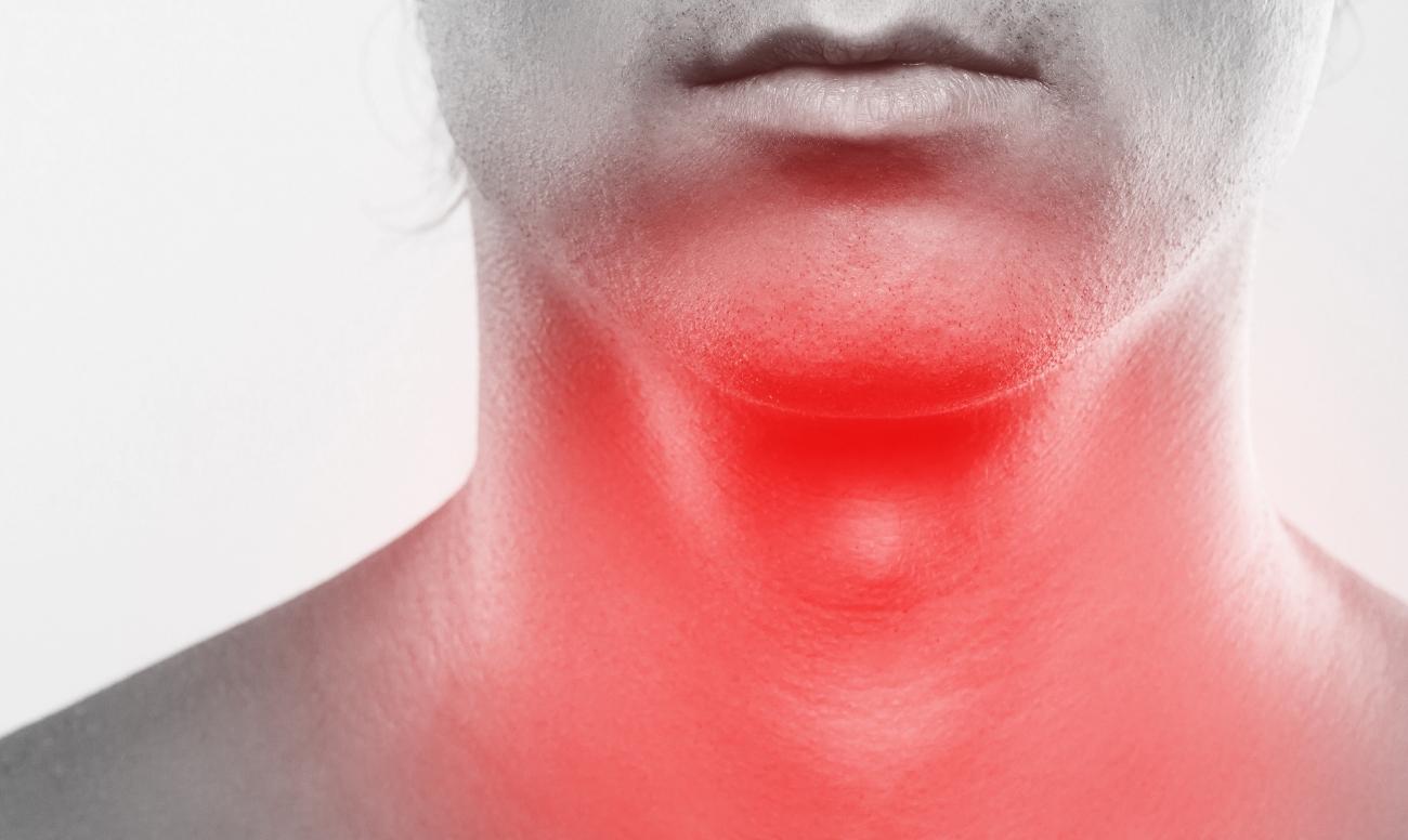 Reflusso gastroesofageo: il bruciore alla gola tra i sintomi esofagei