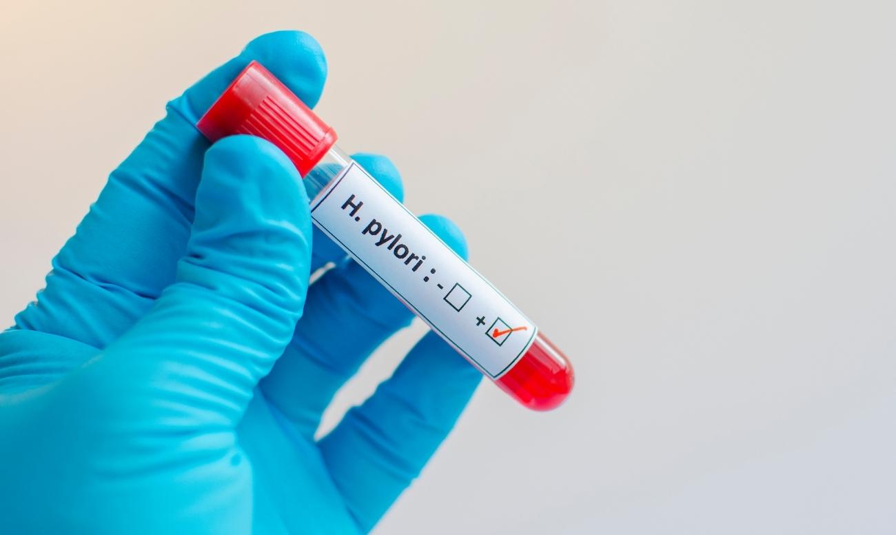 Test per l'Helicobacter pilory mostra la positività al batterio